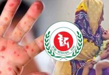 হাম উপসর্গে ৬ জনের মৃত্যু